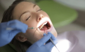 Dental Bonding for Chipped Teeth Pros and Cons
