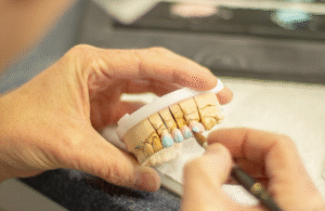 How to Choose the Right Veneer Type in India