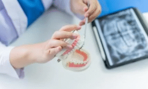 Risks and Causes of Implant Failure