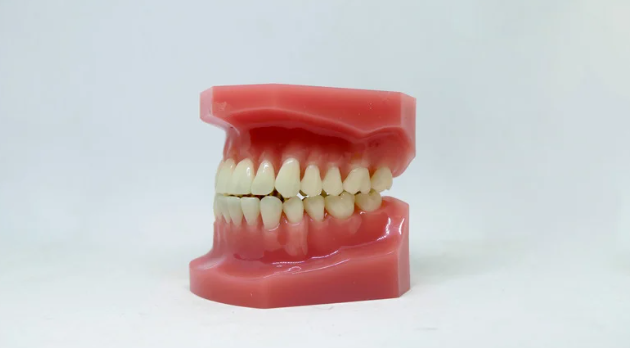 Advantages of Cosmetic Gum Surgery for a Gummy Smile in India